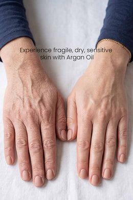 Two hands, one with visible signs of dryness and fatigue and the other smoother and well nourished by Druide Argan Oil hand cream, on a white background with text about Argan Oil.